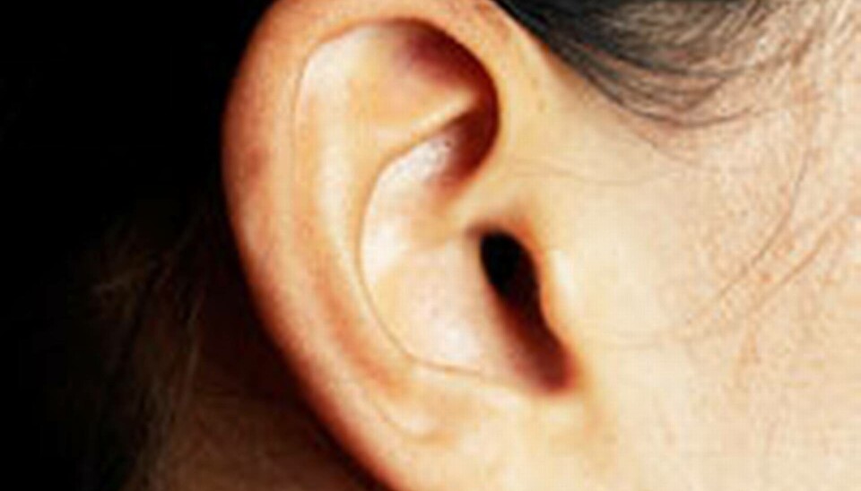 Simulering av en nerv i nacken ska stoppa tinnitus, som 15 procent av svenskarna lider av. Foto: Colourbox