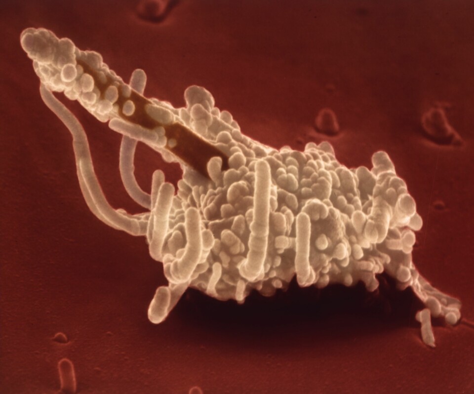 En makrofag, den cell som försvarar lungor mot ingrepp omringar förgäves ett asbestfiber i lungan.
